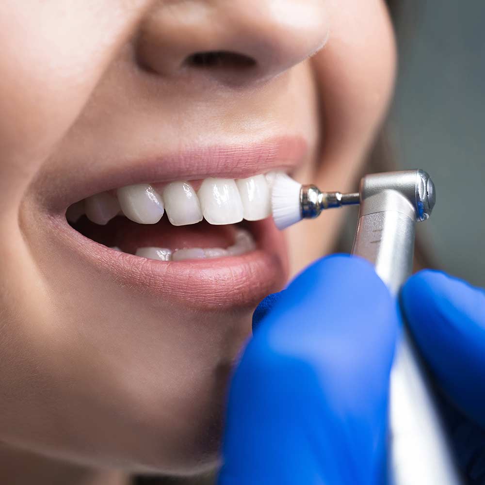 Dental hygiene check at Hygienist London Clinic